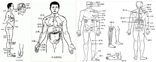 针灸治疗弱视