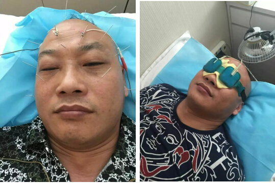 干眼症：不得不诉的苦