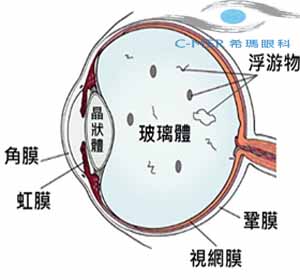 你知道自已为什么会得飞蚊症吗？