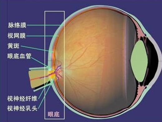 视网膜脱落的主要症状