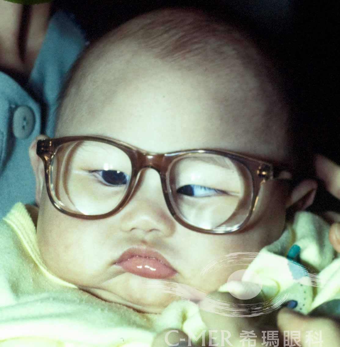 哪些孩子容易得弱视 哪些孩子容易得弱视