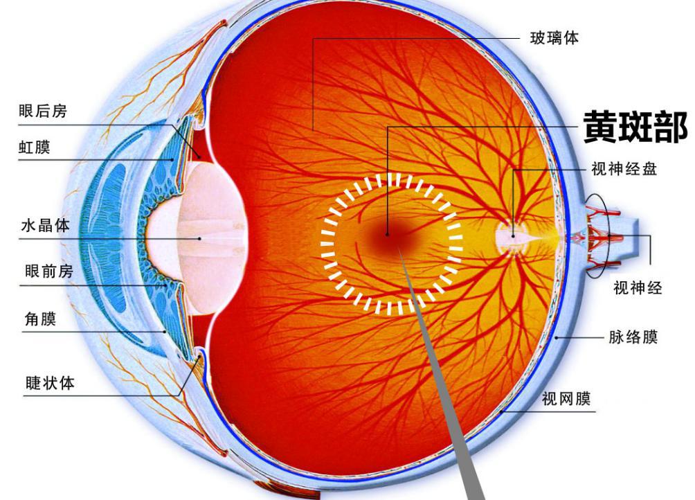 黄斑前膜--黄斑表面长“膜”了