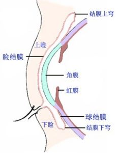 结膜在哪里？来看看它的常发眼病