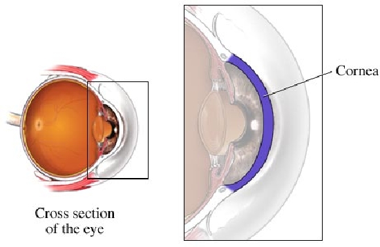 眼角膜过薄为什么不能做激光近视手术