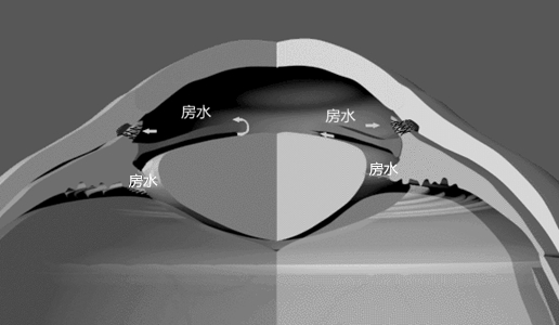 关灯,玩,手机,易诱发,易,诱发,青光眼,严重,寒,