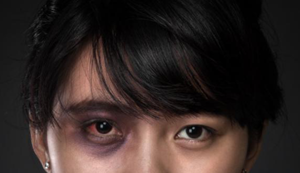 眼病科普
